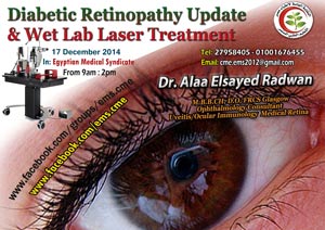 Diabetic Retinopathy Update & Wet lab laser treatment